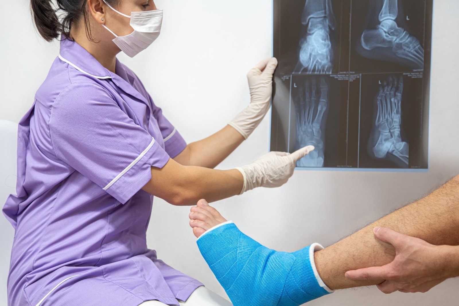 Fracture Treatment in Delhi | Dr Apoorv Dua