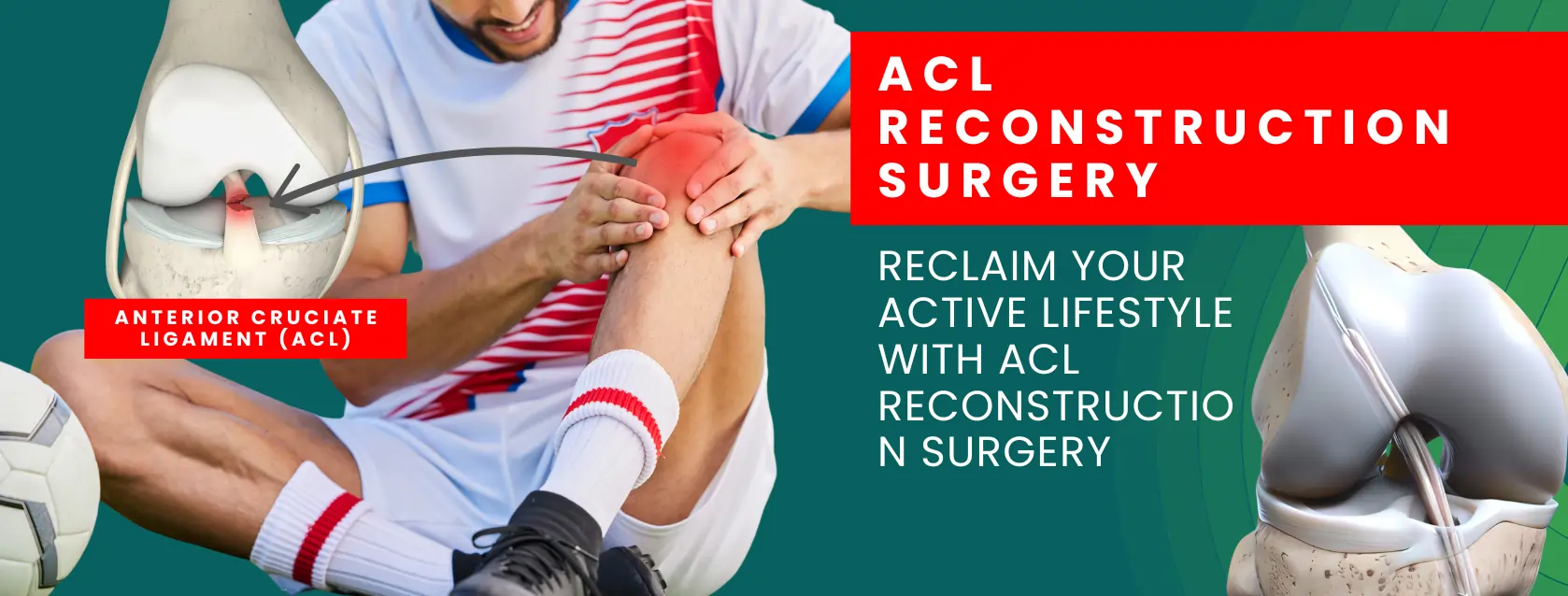 ACl-injury
