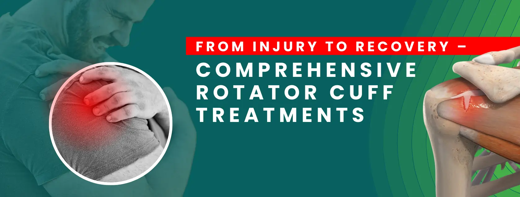 Rotator-cuff