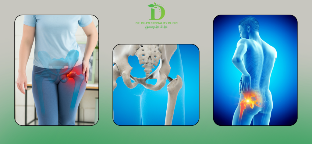 Patient walking after hip replacement surgery in Delhi showing pain-free mobility recovery