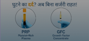 knee-pain-treatment-without-surgery-prp-gfc-vasant-kunj.jpg